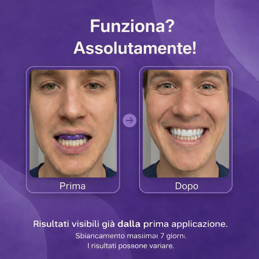 Vioren - Strisce sbiancanti viola per i denti