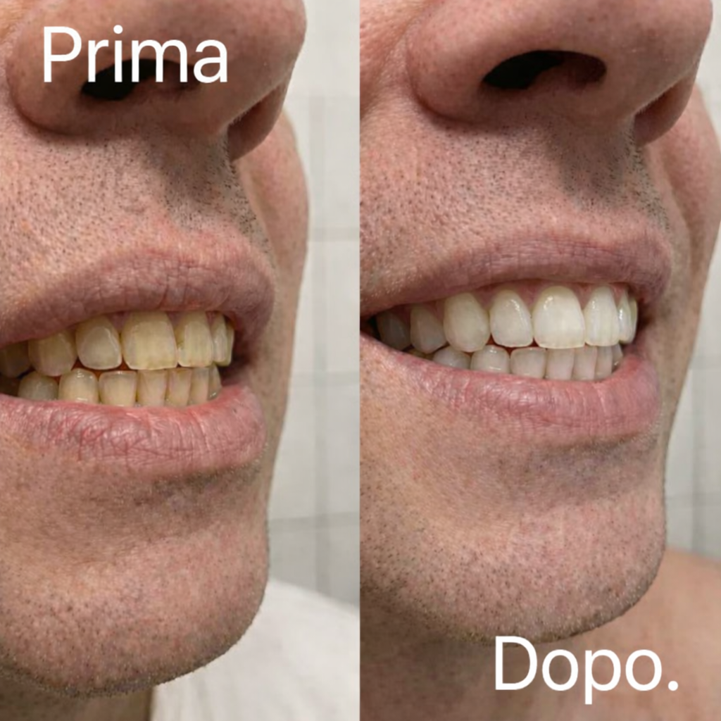 Foto reale prima e dopo Vioren